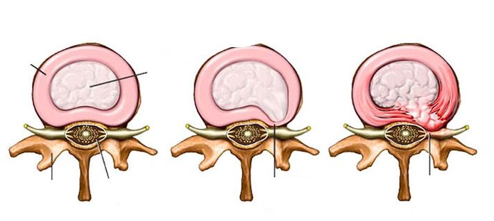 Changements vasculaires