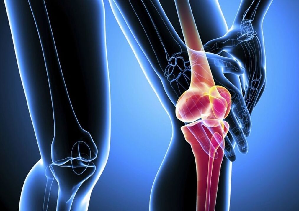 Douleur pendant l'activité physique dans l'arthrose de l'articulation du genou