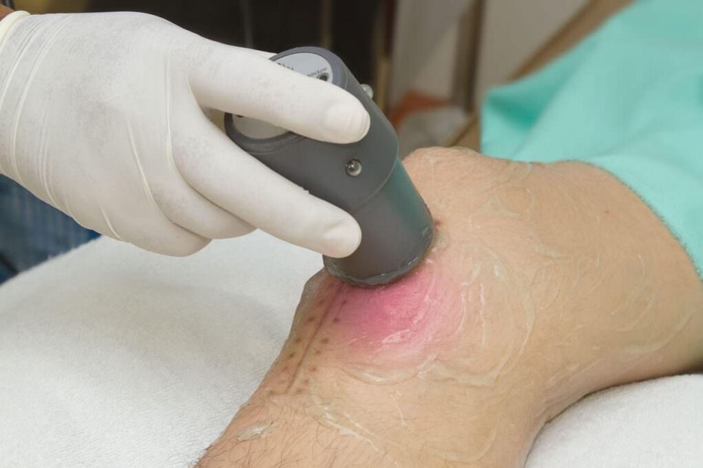 Procédure de phonophorèse pour l'arthrite de l'articulation du genou