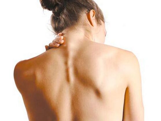 La fille souffre d'ostéochondrose cervicale