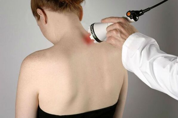 mesures physiothérapeutiques pour le traitement de l'ostéochondrose cervicale