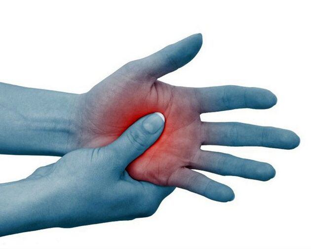 Une douleur intense dans les articulations des doigts, diminuant avec l'exercice, est un signe typique de la polyarthrite rhumatoïde.